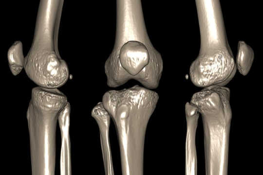 When Joints Pop And Crack Is It A Sign Of Disease?