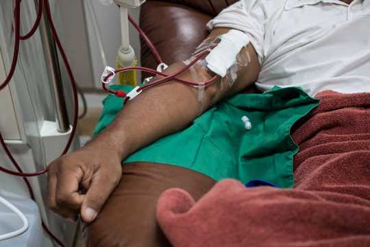 What Is Chronic Kidney Disease And Why Are One In Three At Risk Of This Silent Killer?