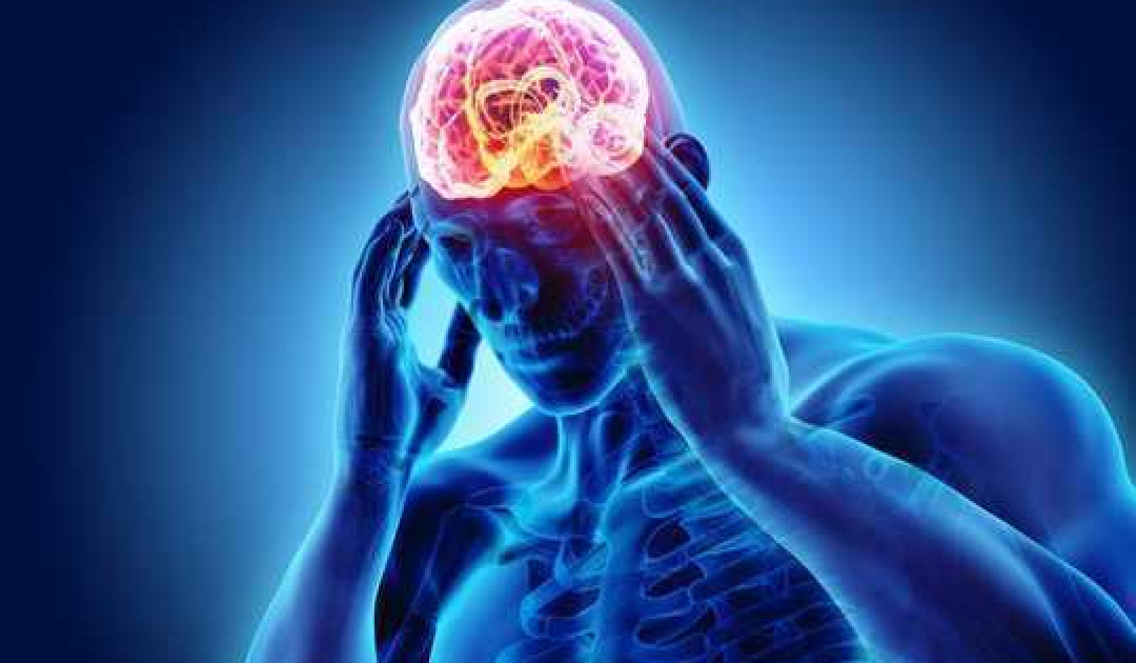 Why The Cluster Headache Is More Than Just A Headache