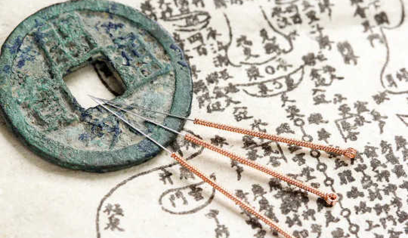 This Ancient Chinese Anatomical Atlas Changes What We Know About Acupuncture And Medical History