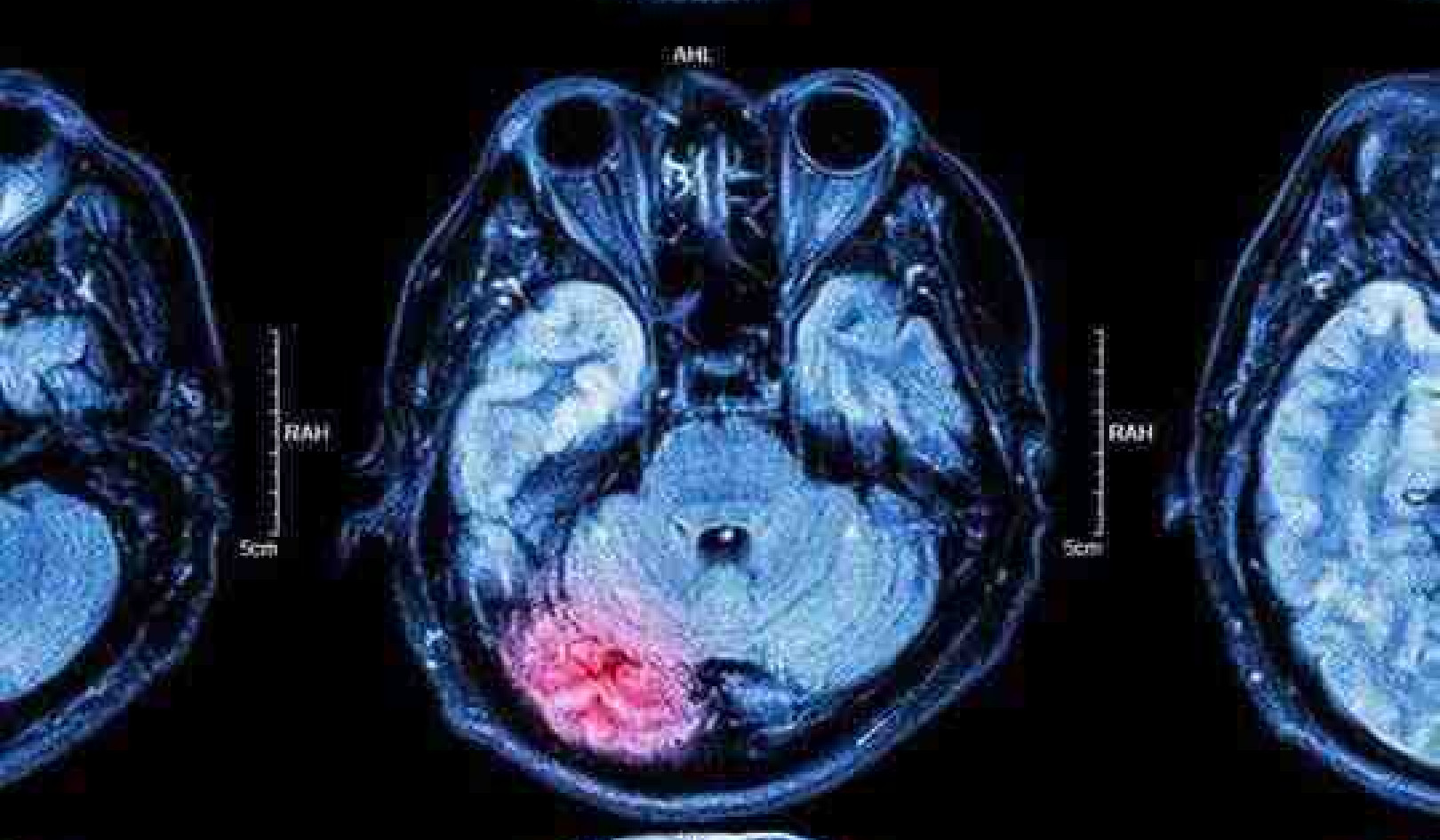 How Injuries Change Our Brain and How We Can Help It Recover