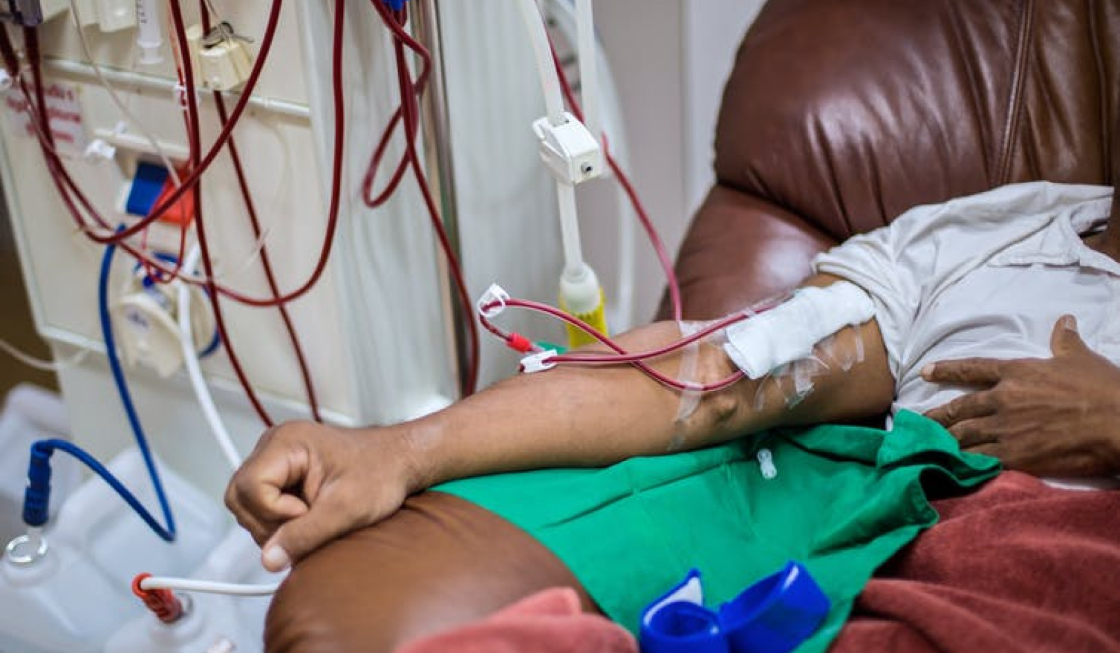 A Quarter Of Kidney Donors Are Living: What You Need To Know About Being A Donor