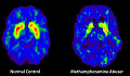 Dopamine Fasting: An Expert Reviews The Latest Craze