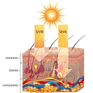 What Happens To Your Skin When You Get Sunburnt?