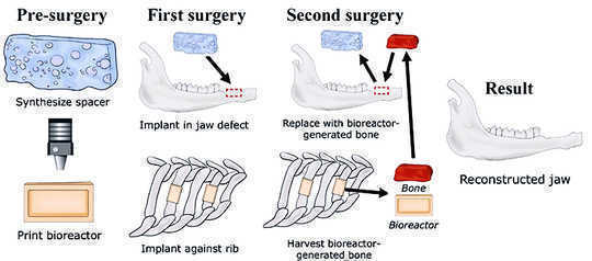 How This Method Grows A New Jawbone From A Rib How This Method Grows A New Jawbone From A Rib