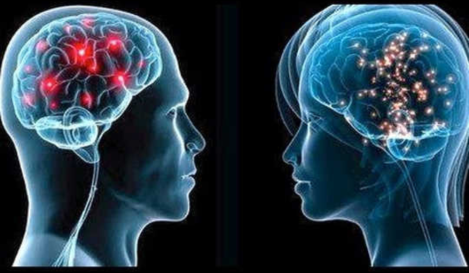 Metabolically, Women Have Younger Brains Than Men